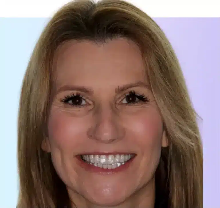 woman with invisalign treatment